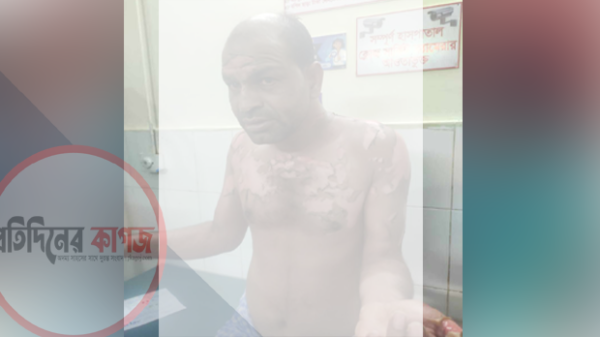 সরিষাবাড়ীতে গরম পানি ঢেলে স্বামীকে হত্যার চেষ্টা স্ত্রীর