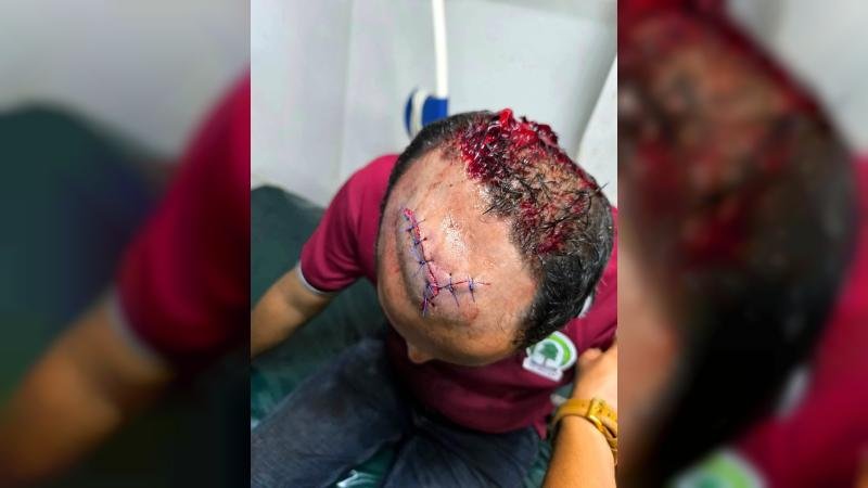 কক্সবাজারে বনভূমি উচ্ছেদ অভিযানে বনকর্মীদের ওপর হামলা, রেঞ্জ কর্মকর্তাসহ আহত ৫