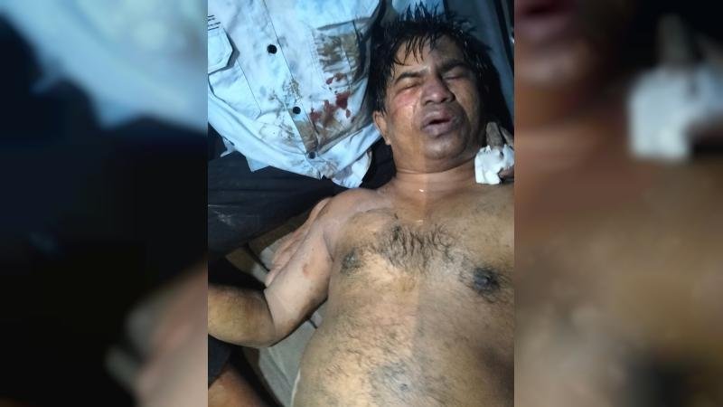 টেকনাফে সাবেক ইউপি সদস্য ও সংবাদকর্মীকে অপহরণ করে হত্যাচেষ্টা, দুই পা ক্ষতবিক্ষত